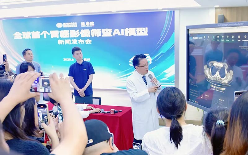 تشخیص زودهنگام سرطان معده با هوش مصنوعی جدید شرکت علی‌بابا